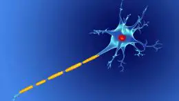 Damaged Myelin Neuron